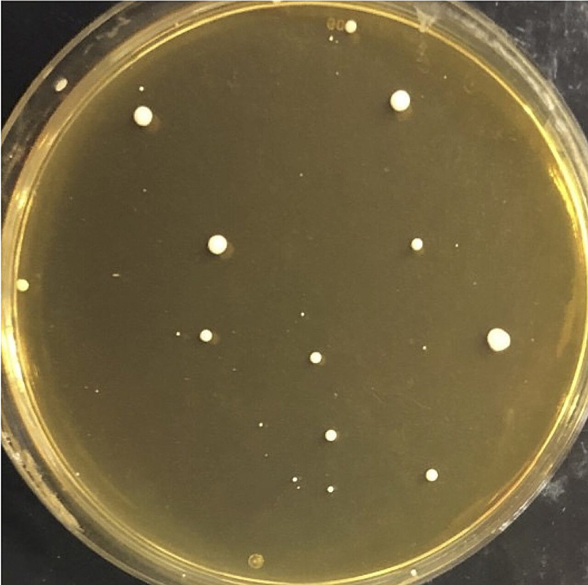 CRISPR & genbewerking