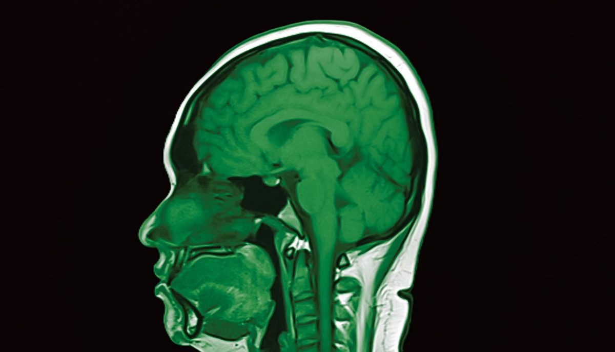 Brain-computer interfaces