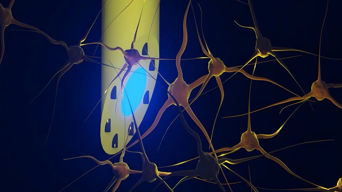 Brain-computer interfaces