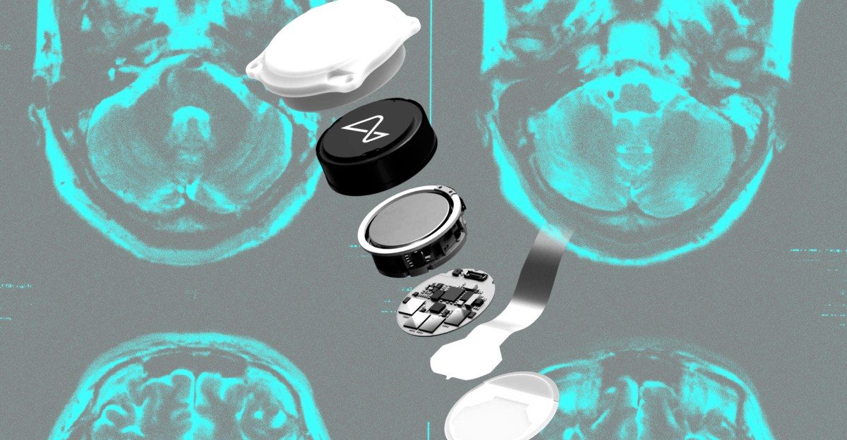 Brain-computer interfaces